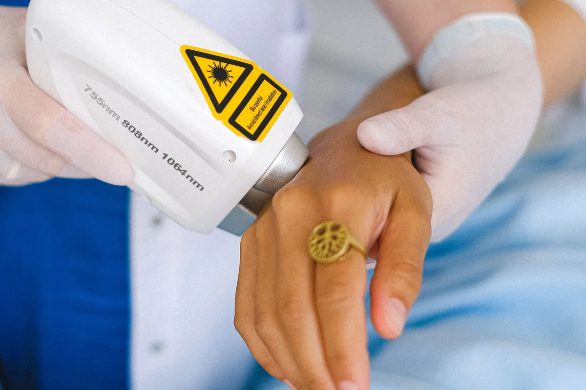 Laser handpiece with a warning label held over a patient's hand during laser tattoo removal in Malaysia